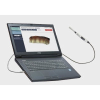 Sale CondorScan Intraoral Scanner CAD/CAM