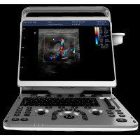 Sale Chison eBit 50 Ultrasound Color Doppler Portable Advanced 15" LED Battery 1 Probe