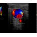 GE Logiq E Ultrasound - Sale