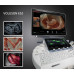 GE Voluson E10 Ultrasound Machine - Sale