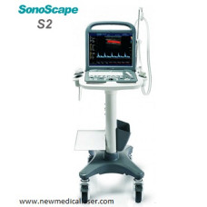 Sonoscape S2 Ultrasound - Sale